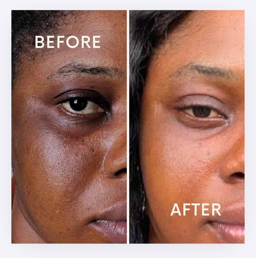 Rejuvena Face Kit